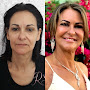 Dra. Roberta Straccioni - Especialista em Harmonizao Facial