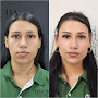 Harmonize Esttica Avanada